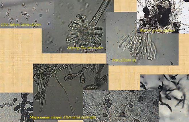 Webinar ‘Kola Arctic microorganisms: theoretical and applied aspects’